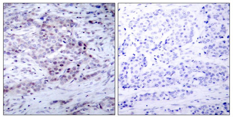 NFκB-p100/p52(Phospho-Ser870) Rabbit Polyclonal Antibody, 100 ug