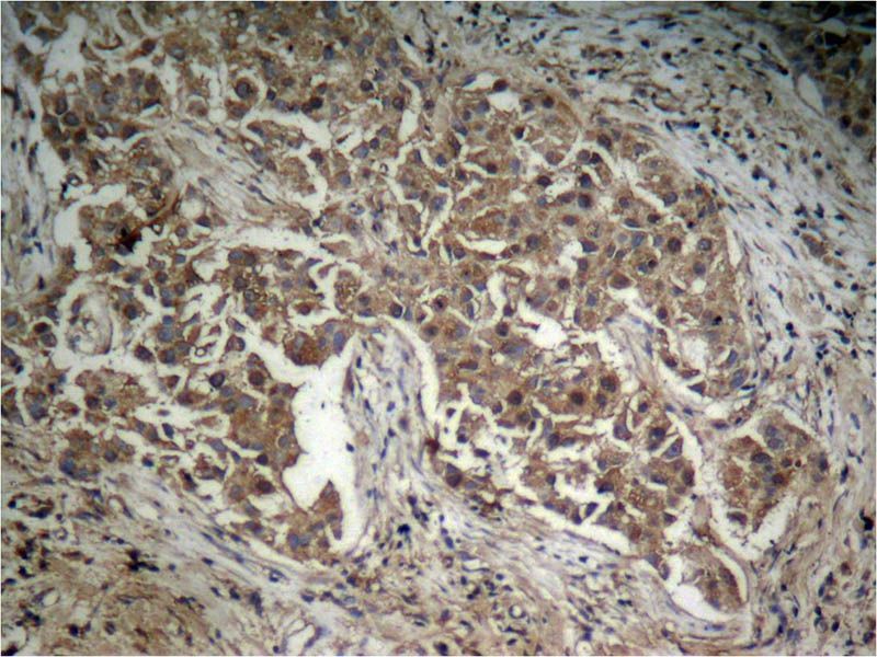 Akt (Phospho-Thr308) Rabbit Polyclonal Antibody, 100 ug