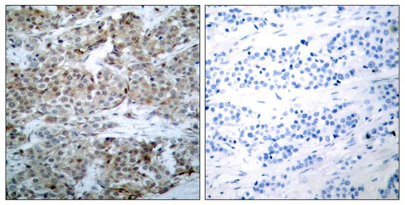 BAD (Phospho-Ser112) Rabbit Polyclonal Antibody, 100 ug