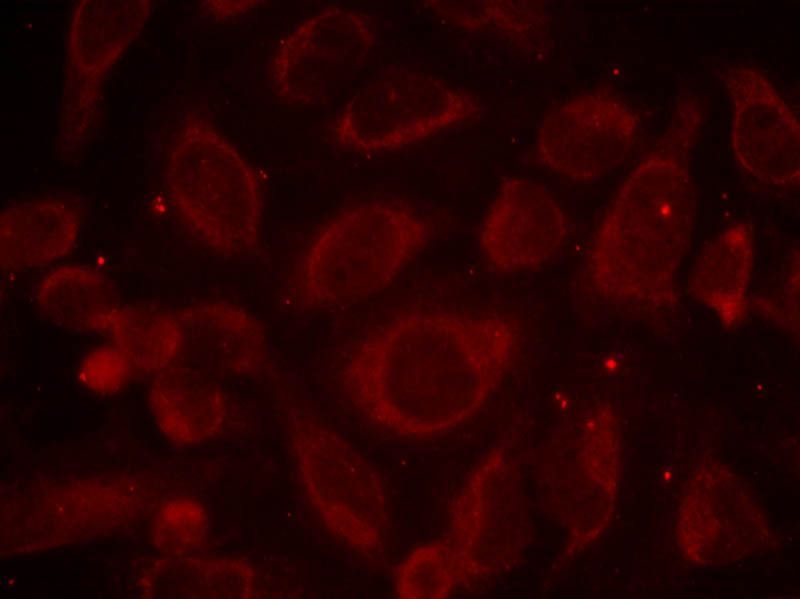 NFκB-p65(Phospho-Ser468) Rabbit Polyclonal Antibody, 100 ug
