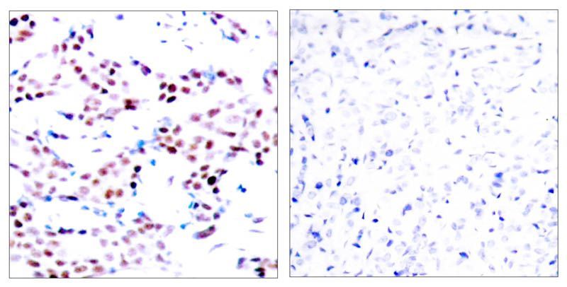 c-Jun (Phospho-Thr91) Rabbit Polyclonal Antibody, 100 ug