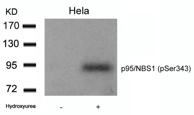 p95/NBS1 (Phospho-Ser343) Rabbit Polyclonal Antibody, 100 ug