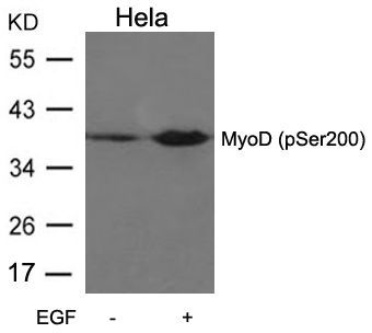 MyoD (Phospho-Ser200) Rabbit Polyclonal Antibody, 100 ug