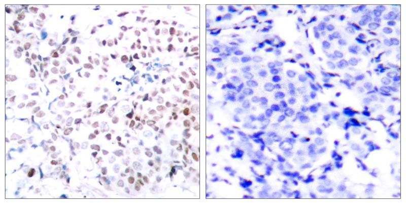 Myc (Phospho-Thr358) Rabbit Polyclonal Antibody, 100 ug