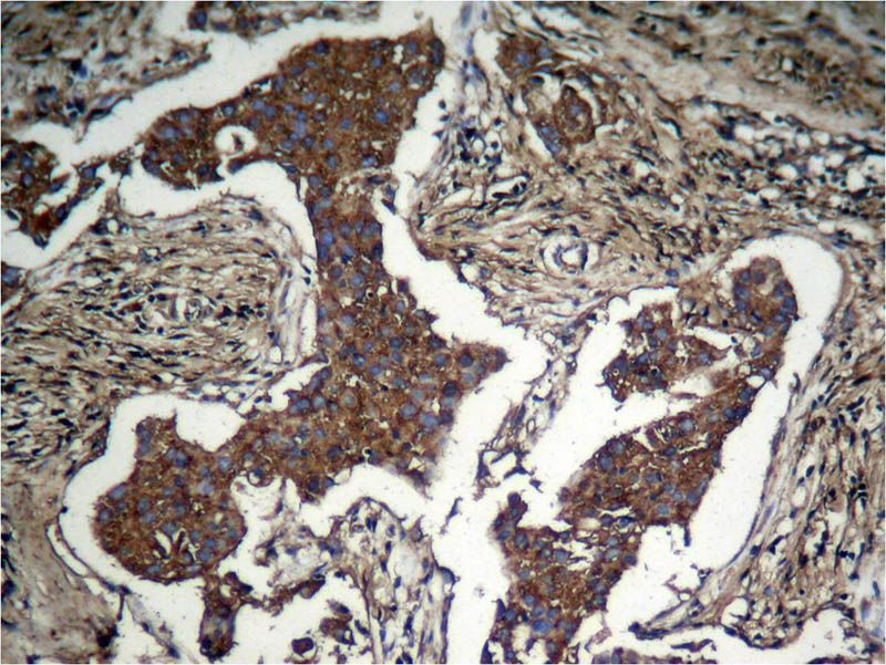 Akt (Phospho-Ser473) Rabbit Polyclonal Antibody, 100 ug