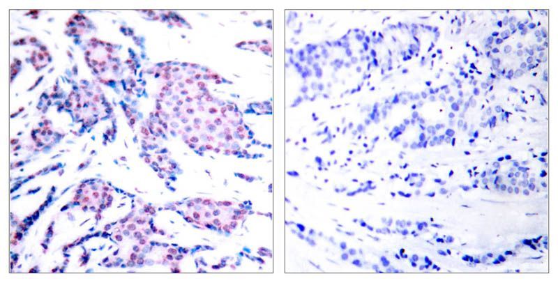 c-Jun (Phospho-Thr93) Rabbit Polyclonal Antibody, 100 ug