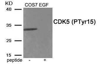CDK5 (Phospho-Tyr15) Rabbit Polyclonal Antibody, 100 ug