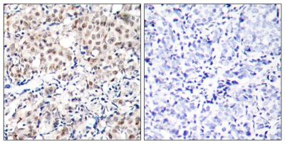 p27Kip1 (Phospho-Thr187) Rabbit Polyclonal Antibody, 100 ug