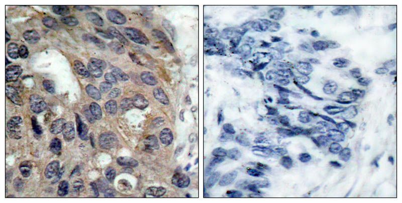 Src (Phospho-Tyr529) Rabbit Polyclonal Antibody, 100 ug