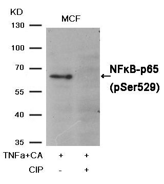 Pyk2 (Phospho-Tyr402) Rabbit Polyclonal Antibody, 100 ug