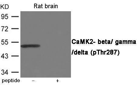 CaMK2- beta/ gamma/ delta (Phospho-Thr287) Rabbit Polyclonal Antibody, 100 ug