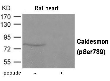 Caldesmon (Phospho-Ser789) Rabbit Polyclonal Antibody, 100 ug