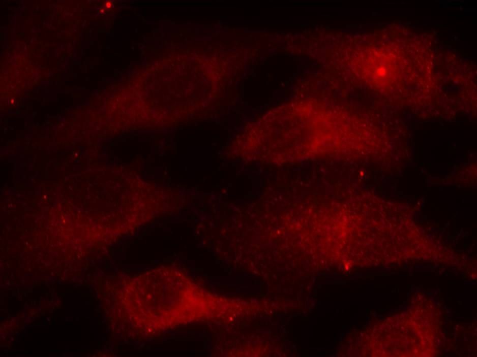 Caveolin-1 (Phospho-Tyr14) Rabbit Polyclonal Antibody, 100 ug