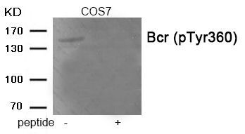 Bcr (Phospho-Tyr360) Rabbit Polyclonal Antibody, 100 ug