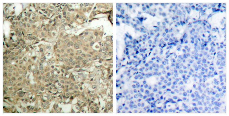 cofilin (Phospho-Ser3) Rabbit Polyclonal Antibody, 100 ug