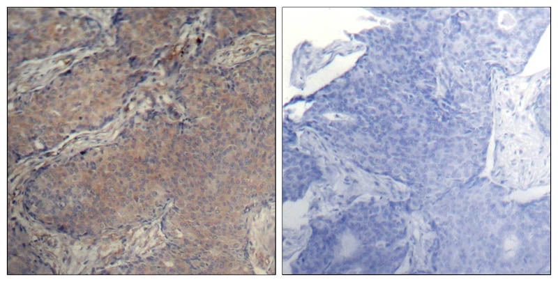 Myosin Light Chain 2 (Phospho-Ser19) Rabbit Polyclonal Antibody, 100 ug