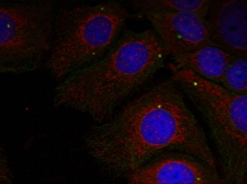 α-Synuclein (Phospho-Tyr125) Rabbit Polyclonal Antibody, 100 ug