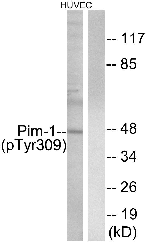 Pim-1 (Phospho-Tyr309) Rabbit Polyclonal Antibody, 100 ug