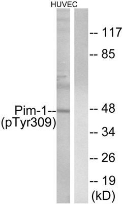 Pim-1 (Phospho-Tyr309) Rabbit Polyclonal Antibody, 100 ug