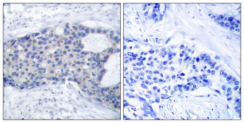 MEK1 (Phospho-Ser221) Rabbit Polyclonal Antibody, 100 ug