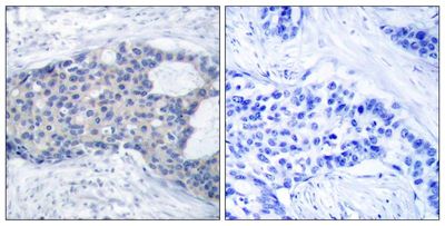 MEK1 (Phospho-Ser221) Rabbit Polyclonal Antibody, 100 ug MEK1 (Phospho-Ser221) Rabbit Polyclonal Antibody, 100 ug