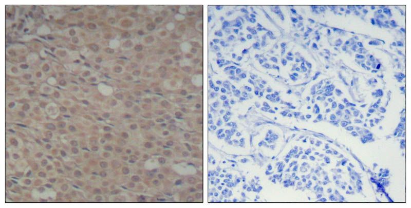 Smad3 (Phospho-Ser425) Rabbit Polyclonal Antibody, 100 ug