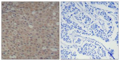 Smad3 (Phospho-Ser425) Rabbit Polyclonal Antibody, 100 ug