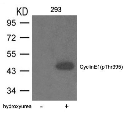 Cyclin E1 (phospho-Thr395) Rabbit Polyclonal Antibody, 100 ug