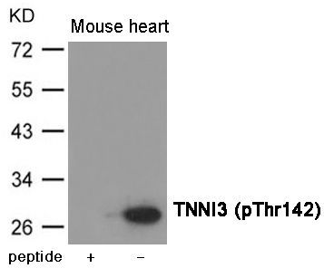 TNNI3 (Phospho-Thr142) Rabbit Polyclonal Antibody, 100 ug