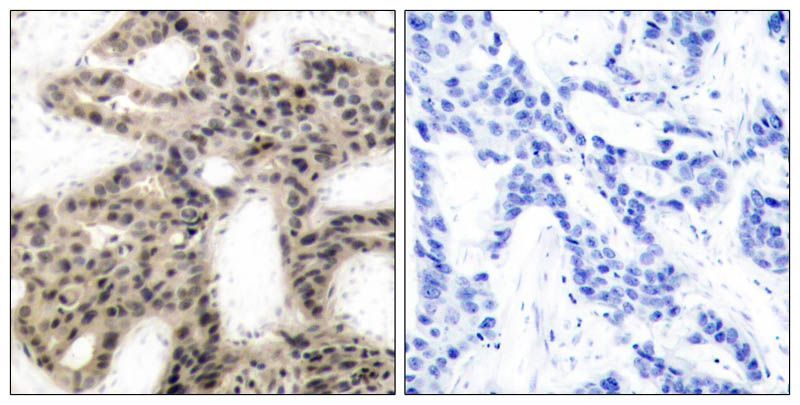 4E-BP1 (Phospho-Thr45) Rabbit Polyclonal Antibody, 100 ug