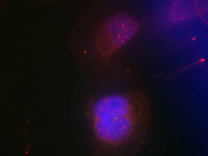 BRCA1 (Phospho-Ser988) Rabbit Polyclonal Antibody, 100 ug