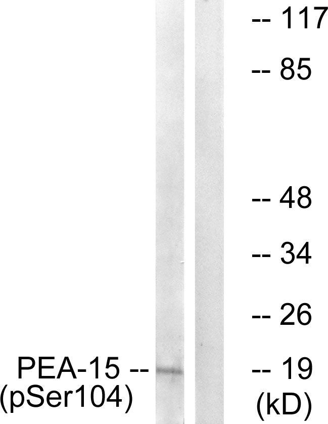 PEA-15 (Phospho-Ser104) Rabbit Polyclonal Antibody, 100 ug