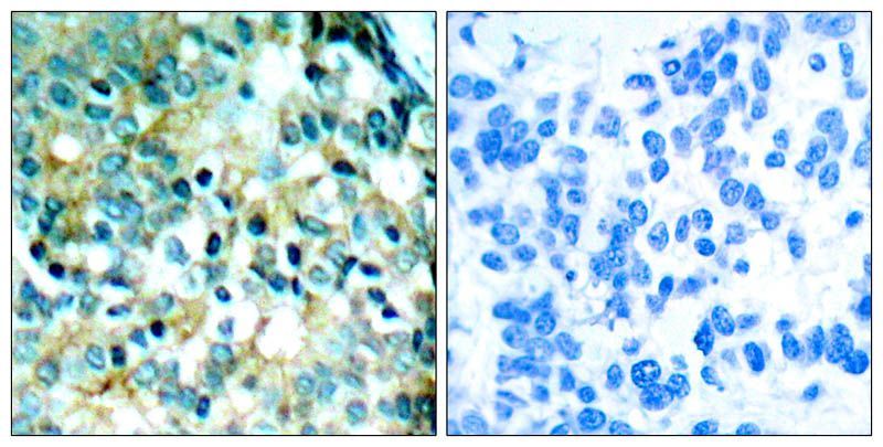 Src(Phospho-Tyr418) Rabbit Polyclonal Antibody, 100 ug