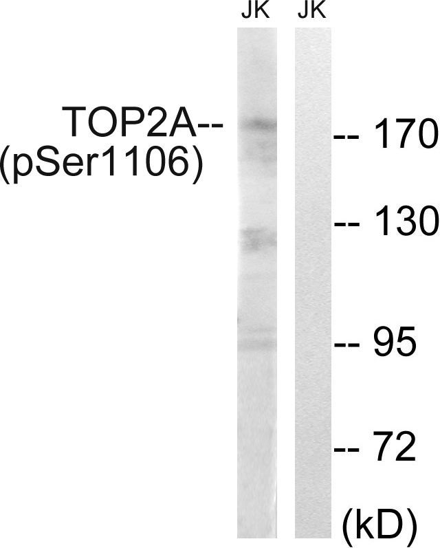 TOP2A (Phospho-Ser1106) Rabbit Polyclonal Antibody, 100 ug