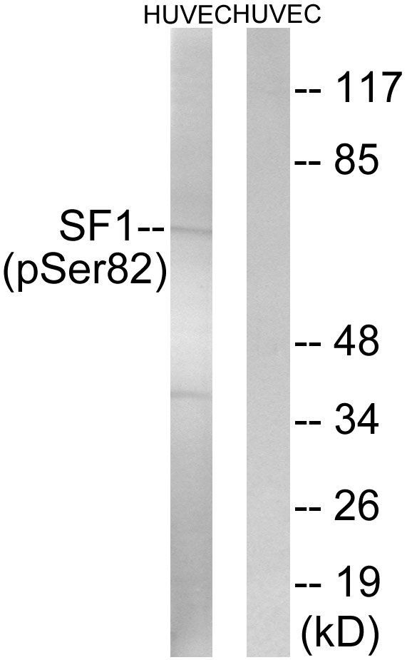 SF1 (Phospho-Ser82) Rabbit Polyclonal Antibody, 100 ug
