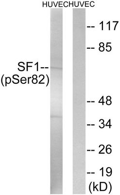 SF1 (Phospho-Ser82) Rabbit Polyclonal Antibody, 100 ug