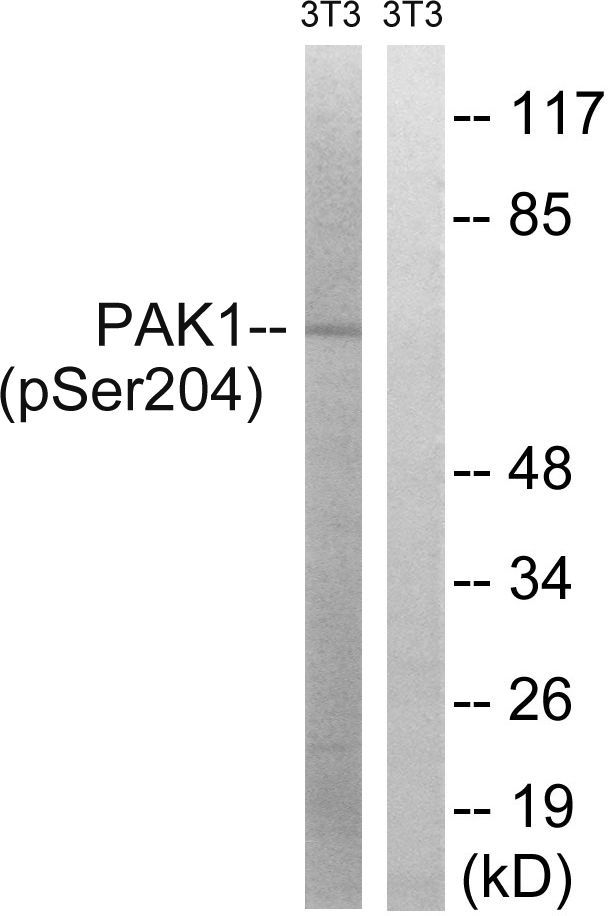 PAK1 (Phospho-Ser204) Rabbit Polyclonal Antibody, 100 ug