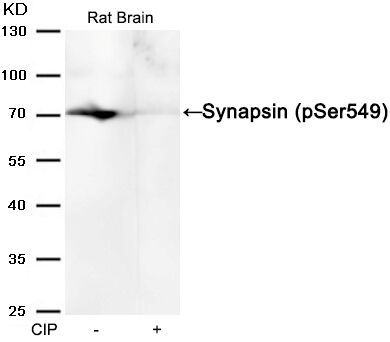 Synapsin (phospho-Ser549) Rabbit Polyclonal Antibody, 100 ug