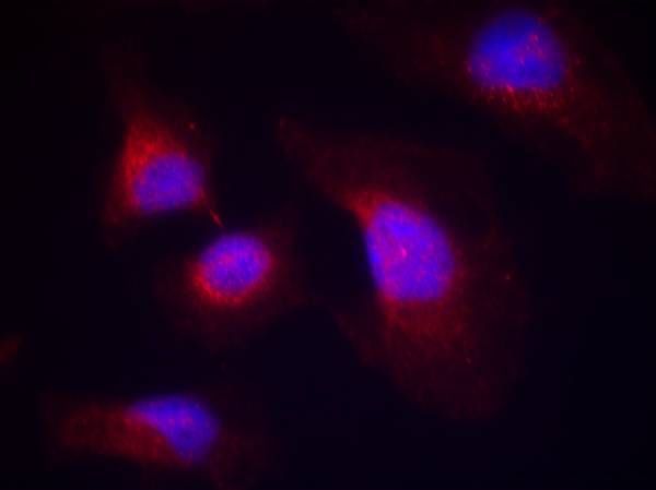 syk (phospho-Tyr323) Rabbit Polyclonal Antibody, 100 ug
