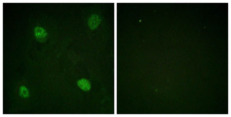 hnRPD (Phospho-Ser83) Rabbit Polyclonal Antibody, 100 ug