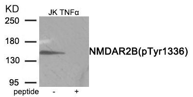 NMDAR2B (Phospho-Tyr1336) Rabbit Polyclonal Antibody, 100 ug