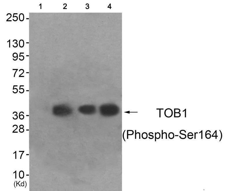 TOB1 (Phospho-Ser164) Rabbit Polyclonal Antibody, 100 ug