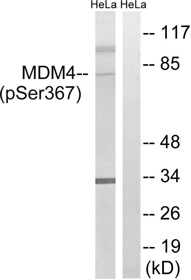 MDM4 (Phospho-Ser367) Rabbit Polyclonal Antibody, 100 ug