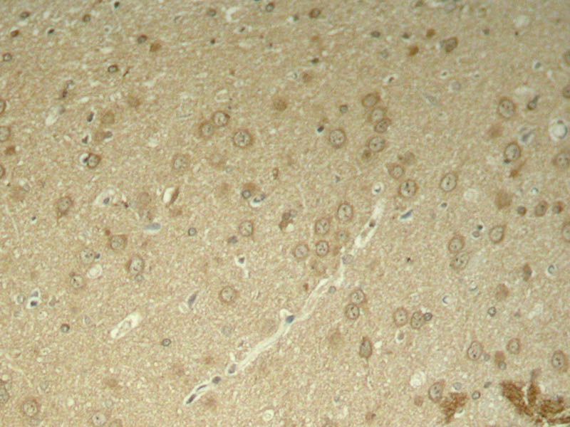 Tau (Phospho-Thr205) Rabbit Polyclonal Antibody, 100 ug