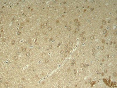 Tau (Phospho-Thr205) Rabbit Polyclonal Antibody, 100 ug Tau (Phospho-Thr205) Rabbit Polyclonal Antibody, 100 ug