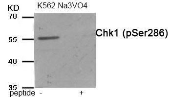 Chk1 (Phospho-Ser286) Rabbit Polyclonal Antibody, 100 ug