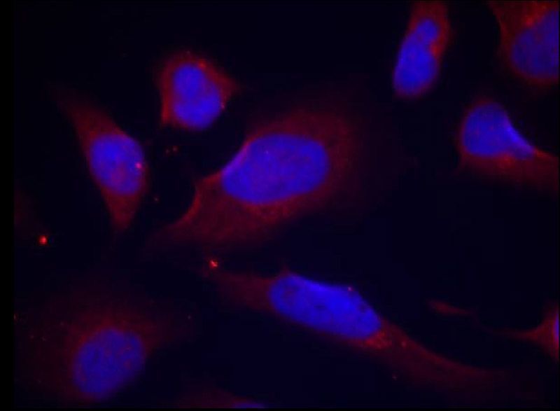 eNOS (Phospho-Ser1177) Rabbit Polyclonal Antibody, 100 ug