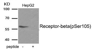 Estrogen Receptor- beta (Phospho-Ser105) Rabbit Polyclonal Antibody, 100 ug
