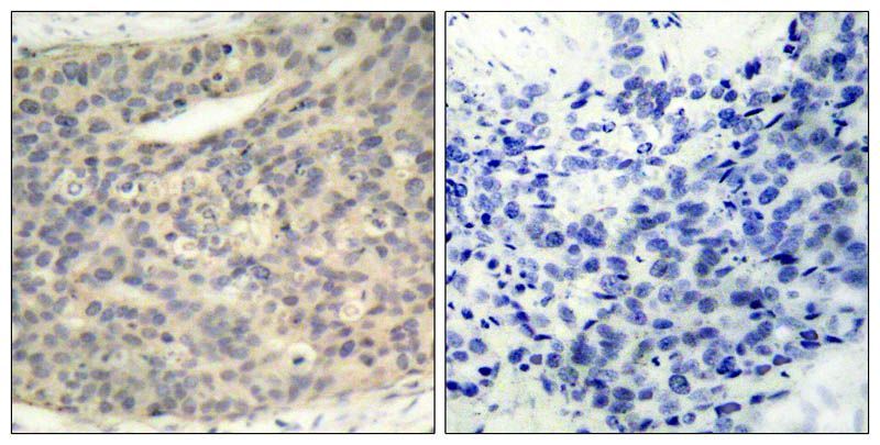 LIMK1 (Phospho-Thr508) Rabbit Polyclonal Antibody, 100 ug