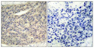 LIMK1 (Phospho-Thr508) Rabbit Polyclonal Antibody, 100 ug LIMK1 (Phospho-Thr508) Rabbit Polyclonal Antibody, 100 ug